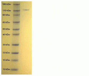 INPP4A, active - Echelon Biosciences
