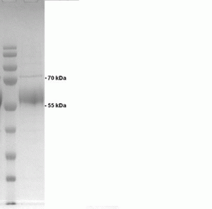 Human Lysosomal Phospholipase A2 (hLPLA2) - Echelon Biosciences
