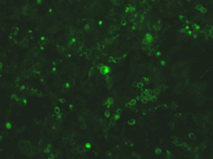 Sphingosine 1-Phosphate Lyase (Overexpression Lysate), active - Echelon Biosciences