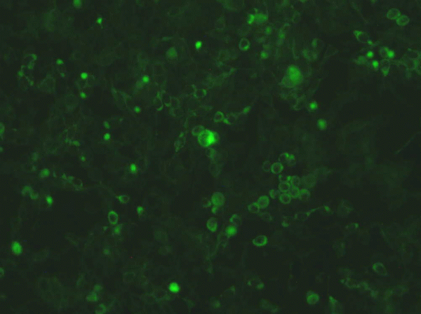 Sphingosine 1-Phosphate Lyase (Overexpression Lysate), active - Echelon Biosciences