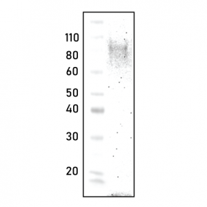 polycolnal Autotaxin antibody - Echelon Biosciences