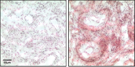Lysophosphatidic Acid Antibody (504B3) - Echelon Biosciences