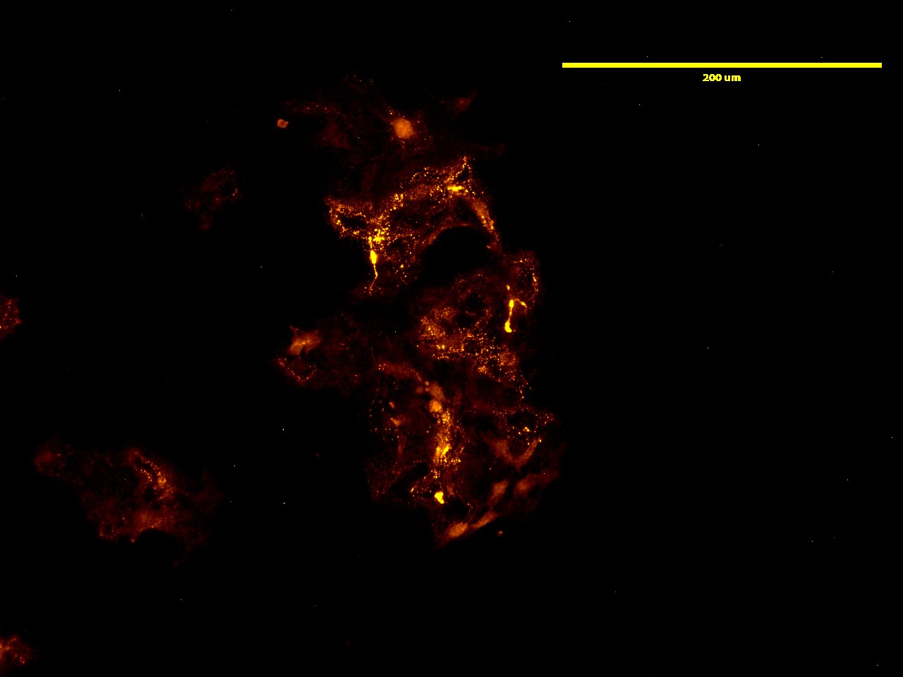 Biotinylated Versican G1 domain - Echelon Biosciences
