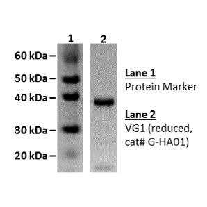Versican G1, hyaluronic acid binding protein - Echelon Biosciences