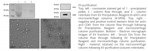 Markers and imaging for Exosome Purification Kit