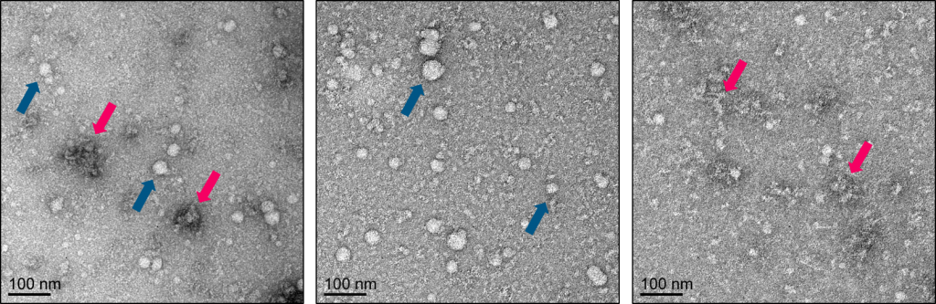Comparison of precipitation versus tandem precipitation and column purification of exosomes and extracellular vesicles - K-4300a ExoClean kit, Echelon Biosciences