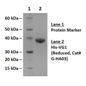 Histidine Tagged Versican G1 Domain - Echelon Biosciences