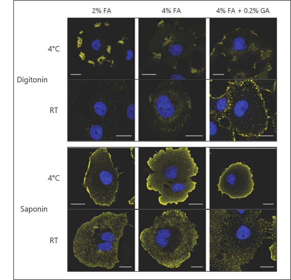 Lipid immunostaining, fixation and permeabilization - Echelon Biosciences