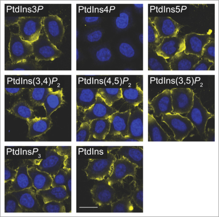 Lipid Immunostaining Part 2 Echelon Biosciences