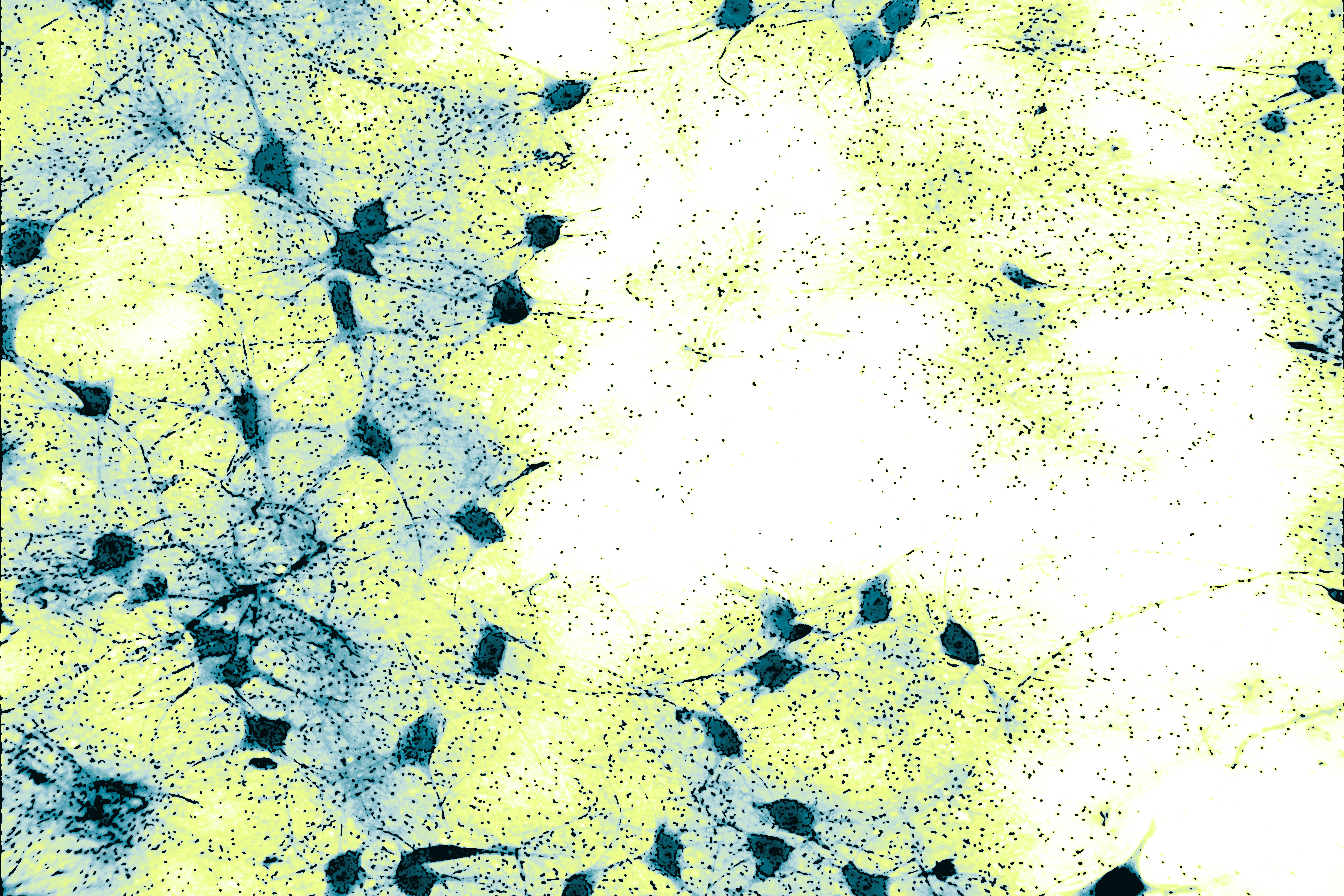 Echelon Biosciences - new evidence shows connection between Synaptotagmin and PIP2 for membrane traffic