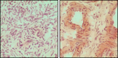 Z-P300 Sphingosine 1-Phosphate Antibody - Echelon Biosciences